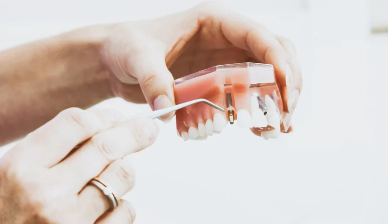 Scientists develop fluoride-free gel that regenerates tooth enamel