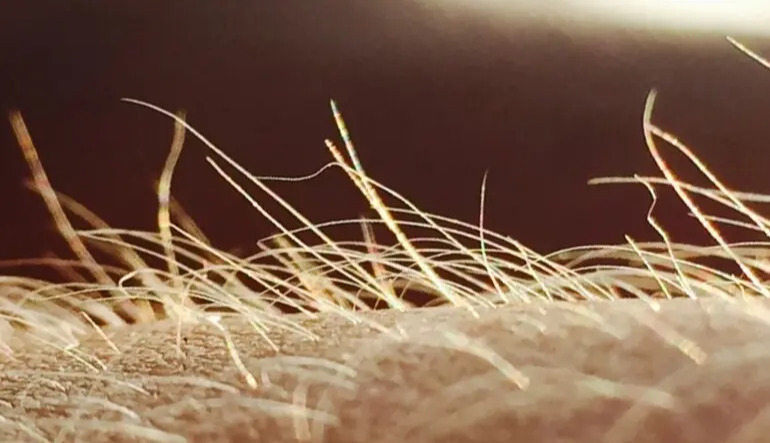 Scientists identify tiny body hairs that may trigger the urge to scratch