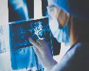 Aggressive breast cancer may hijack nerves to fuel tumor growth