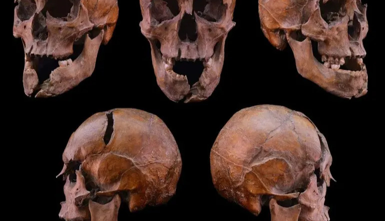 Archaeologists have uncovered a 700-year-old mystery surrounding the murder of a Hungarian duke