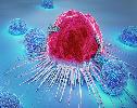 Immune cell profile predicts cancer survival