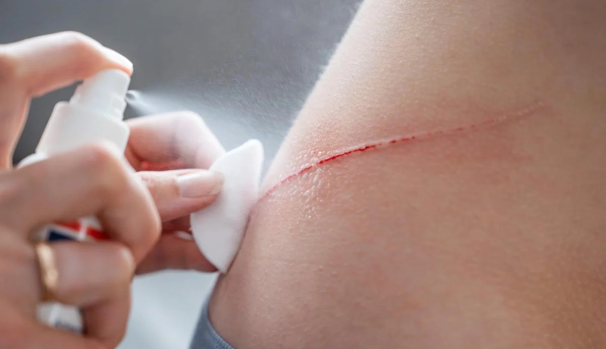 Spray for instant bleeding control receives high praise from scientists