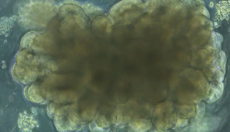 Scientists grew brains in a lab and made them solve engineering problems