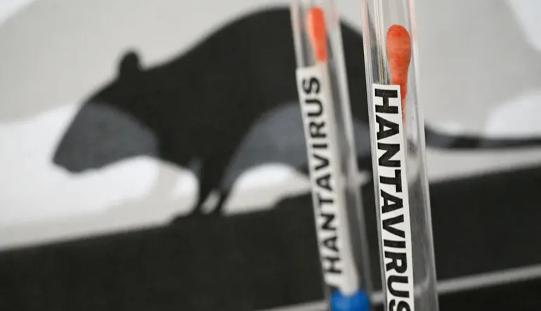 There are no standard treatments for hantavirus infections and no widely available vaccines
